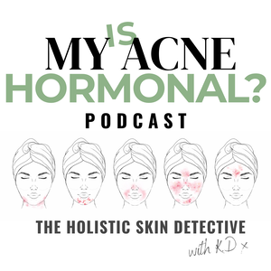 Is My Acne Hormonal?
