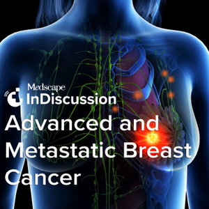 Medscape InDiscussion: Advanced and Metastatic Breast Cancer