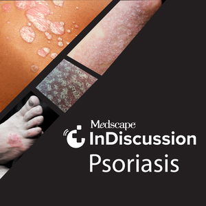 Medscape InDiscussion: Psoriasis