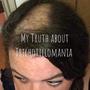 My Truth about Trichotillomania 
