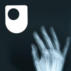 Rheumatoid arthritis - a long term condition - for iPad/Mac/PC