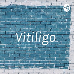 Vitiligo 